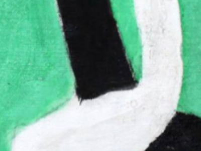 Кровоизлияние в МОСХ