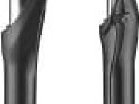 Амортизационная вилка RST Gila TNL 29" (белый 29" 100 мм эксцентрик 9 мм шток 1 1/8" (28.6 мм), сталь)