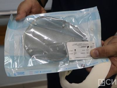 Врачи Республиканской больницы № 2 с начала года проводят краниопластику черепа титановой пластиной