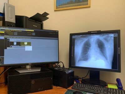 В Якутии онкологические болезни лечат самыми современными методиками