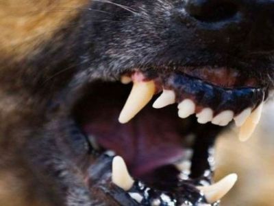 В Якутии ребенок, пострадавший от укусов бродячей собаки, получит компенсацию