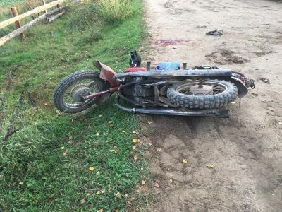 Мотоциклист, ехавший без шлема, получил серьезные травмы в ДТП