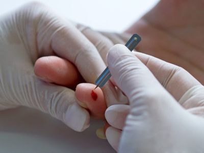 В Якутске проведут бесплатное тестирование на ВИЧ-инфекцию и вирусные гепатиты