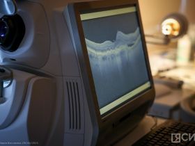 Якутская офтальмологическая больница отмечает 100 лет