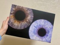 Музей радужки глаза