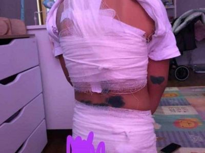 Стая бродячих собак напала на ребенка в Вилюйске