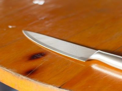 Якутянин месяц проходил с лезвием ножа в спине: врач рассказал о необычном случае из практики