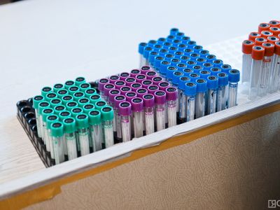 В Якутске пройдет бесплатное экспресс-тестирование на пять инфекций