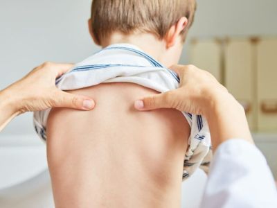 Врач медцентра Якутска: «Нарушение осанки имеет каждый второй подросток»