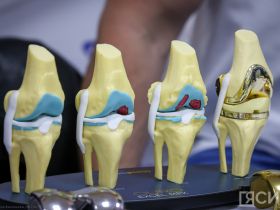 Травматологическая служба Якутии признана лидером в России
