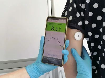 Более 200 беременных якутянок получили системы непрерывного мониторинга глюкозы