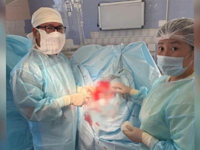 Врачи в Якутии спасли молодого мужчину с переломом черепа после нападения с молотком