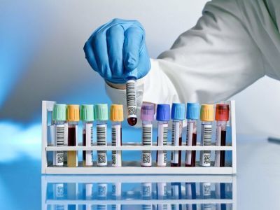 Центр «Вектор»: для профилактики оспы обезьян подходят стандартные меры защиты