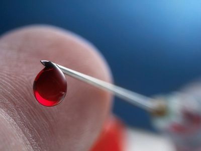 Якутяне могут бесплатно пройти тестирование на ВИЧ и вирусные гепатиты