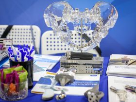 Травматологическая служба Якутии признана лидером в России