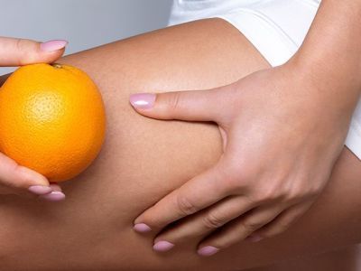 Немецкий тест показал низкую эффективность средств от целлюлита