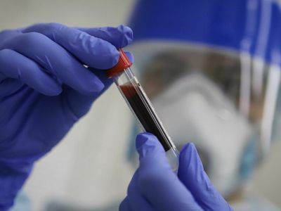 В Роспотребнадзоре разработали детектор, обнаруживающий COVID-19 на самых ранних стадиях