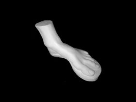 Гипс Стопа Геракла