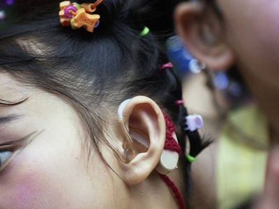 Якутские ученые научились вдвое быстрее определять приводящую к глухоте мутацию