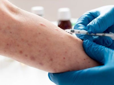 В Роспотребнадзоре рассказали о принимаемых мерах из-за эпидемии оспы обезьян в Африке