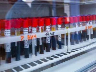 В Якутии наблюдается рост заражений венерическими заболеваниями