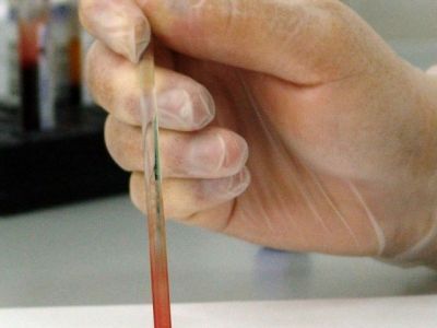 В России разработан новый тест на иммунитет к коронавирусу