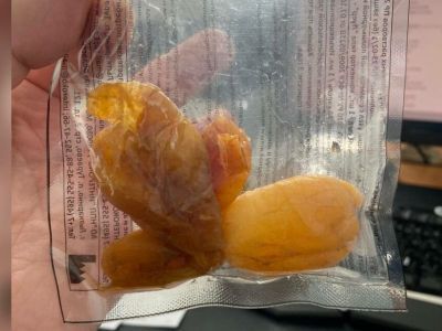 В Якутии врачи достали из кишечника 70-летней женщины три целых абрикоса