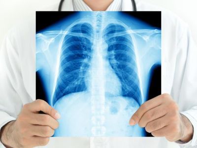 Вахтовика с открытой формой туберкулеза из Усть-Майского района госпитализировали в Якутск