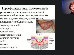 Международный вебинар «Профилактика пролежней, застойной пневмонии, тромбозов и запоров лиц, нуждающихся в постоянном уходе»