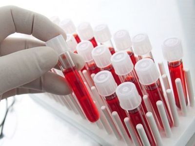 В Якутии в гепатологическом центре активно ведется терапия хронического гепатита С