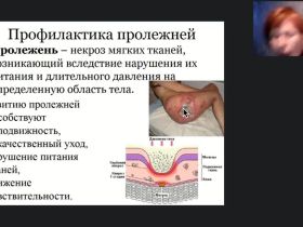 Международный вебинар «Профилактика пролежней, застойной пневмонии, тромбозов и запоров лиц, нуждающихся в постоянном уходе»