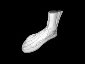 Гипс Стопа анатомическая