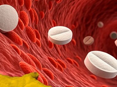 Статины: польза и вред