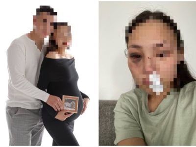 Якутянка обвинила молодого человека в жестоком избиении