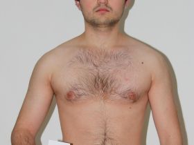 Чемпионат мира по мас-рестлингу. Итоги жеребьевки. Мужчины до 70 кг