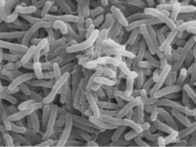 Глава Роспотребнадзора распорядилась усилить меры профилактики холеры