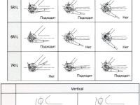 Крепежный комплект для планетарной втулки Shimano 3C41 (гайки) (86.85 мм)