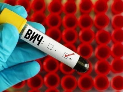 Более 160 новых случаев ВИЧ-инфекции выявили в 2022 году в Якутии