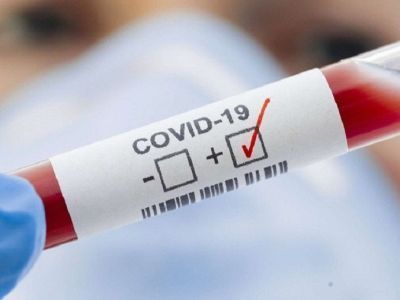 42 новых случая COVID-19 выявлено в Якутии