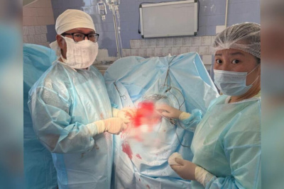 Врачи в Якутии спасли молодого мужчину с переломом черепа после нападения с молотком / Саина Титова   Республика Саха (Якутия)