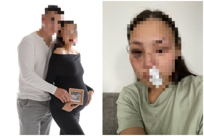 Якутянка обвинила молодого человека в жестоком избиении / Саина Титова   