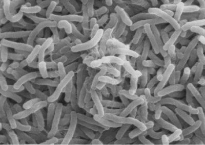 Глава Роспотребнадзора распорядилась усилить меры профилактики холеры / ЯСИА   