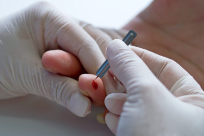 В Якутске проведут бесплатное тестирование на ВИЧ-инфекцию и вирусные гепатиты / ЯСИА Якутск Якутск Республика Саха (Якутия)