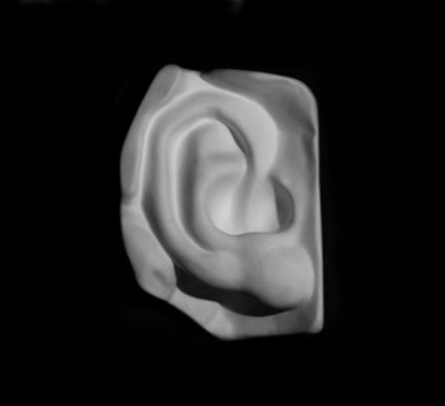 Гипс Ухо Давида правое