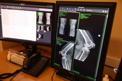 Рентген-кабинет откроют в Серебряном Бору Нерюнгринского района Якутии / ЯСИА  Нерюнгринский Республика Саха (Якутия)