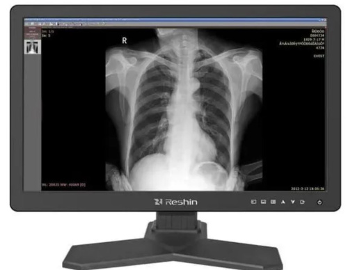 Монитор 21,3" RESHIN MD26GA 2 МП, монохромный, наличие РУ