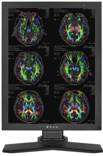 Монитор 21,3" RESHIN MD32C 3МП, цветной, наличие РУ