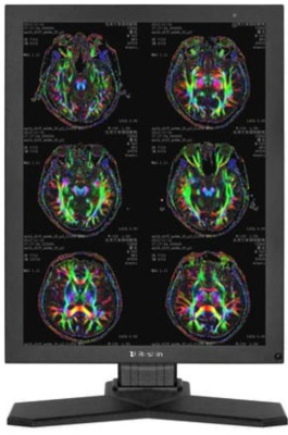 Монитор 21,3" RESHIN MD32C 3МП, цветной, наличие РУ