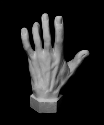 Гипс Кисть вертикальная