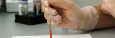 В России разработан новый тест на иммунитет к коронавирусу /    